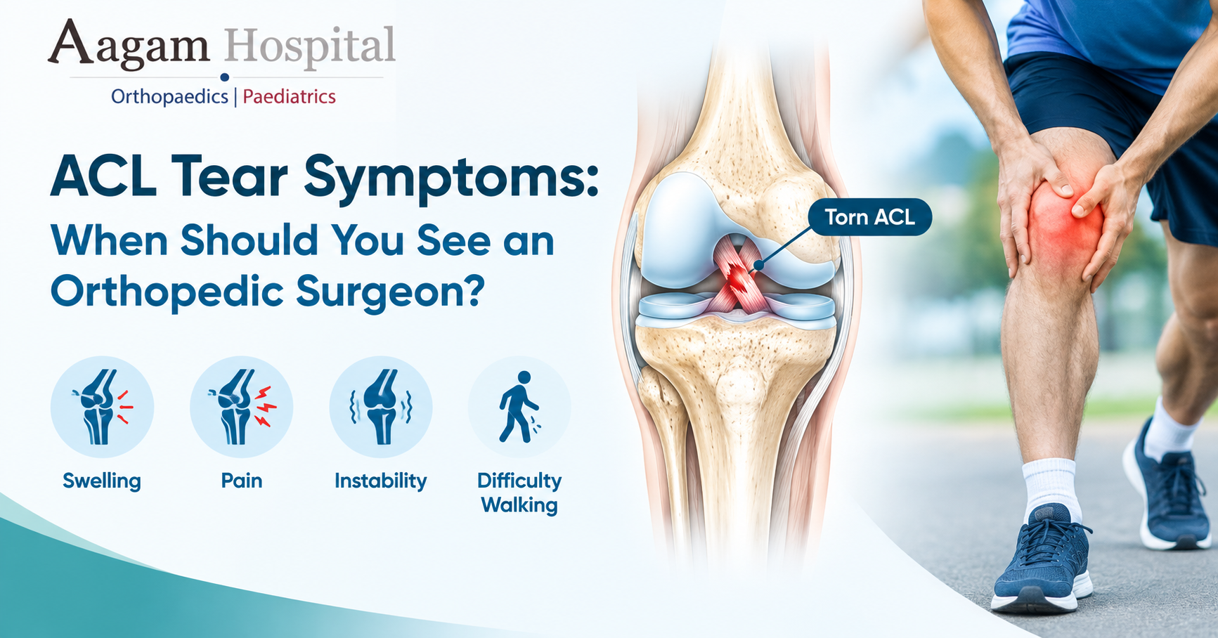 ACL Reconstruction Surgery in Ahmedabad